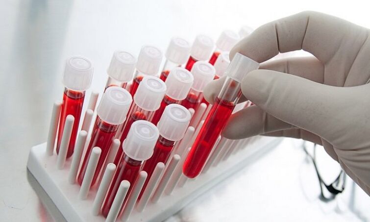 blood in test tubes of a dog with prostatitis